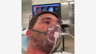 Illustration for article titled A Step-by-Step Breakdown of an Awake Brain Tumor Removal Surgery